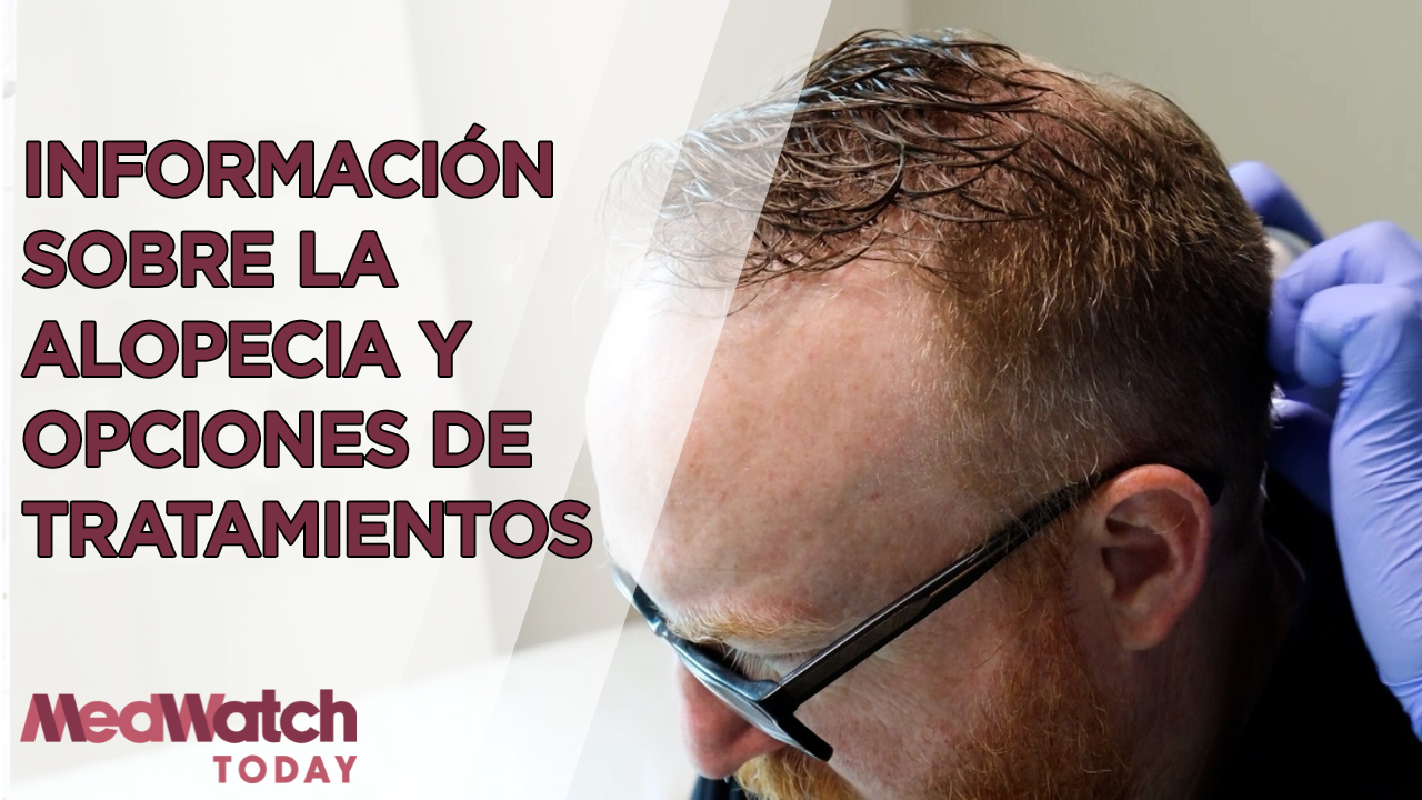 Explicación de la pérdida de cabello: tratamientos y asesoramiento experto de un dermatólogo