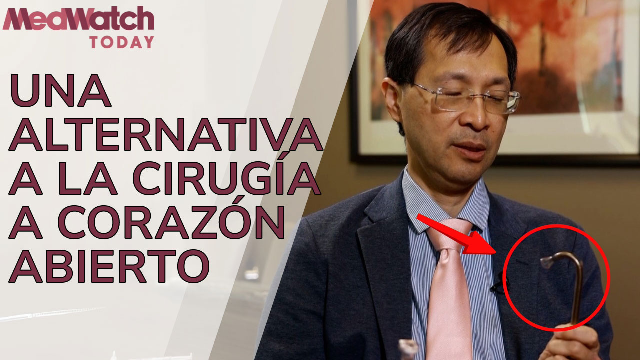 Extracción de coágulos y tumores en el corazón con AngioVac